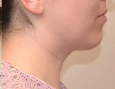 After