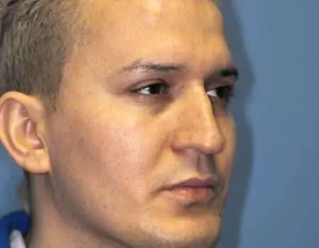 Before