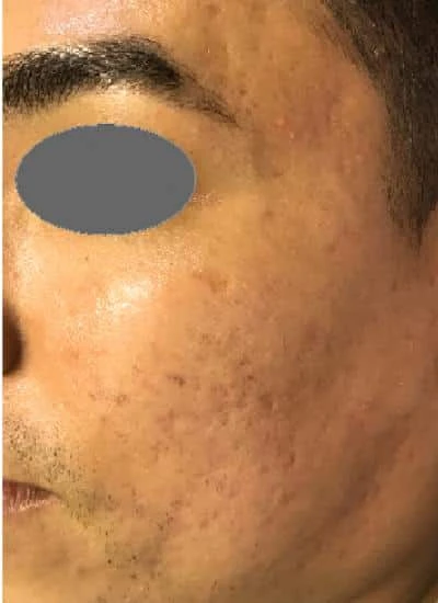 Before
